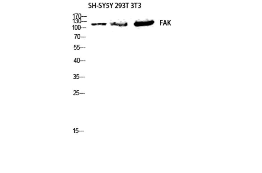 Western Blot - Anti-FAK Antibody (B7082) - Antibodies.com
