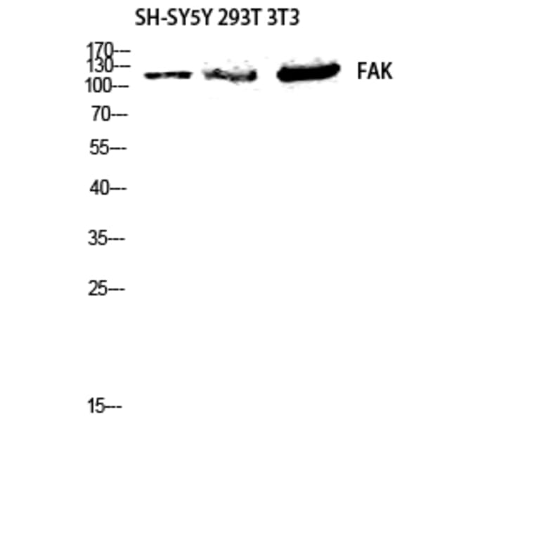 Western Blot - Anti-FAK Antibody (B7082) - Antibodies.com