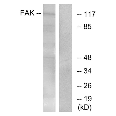 Western Blot - Anti-FAK Antibody (B7081) - Antibodies.com