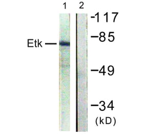 Western Blot - Anti-ETK Antibody (B0645) - Antibodies.com