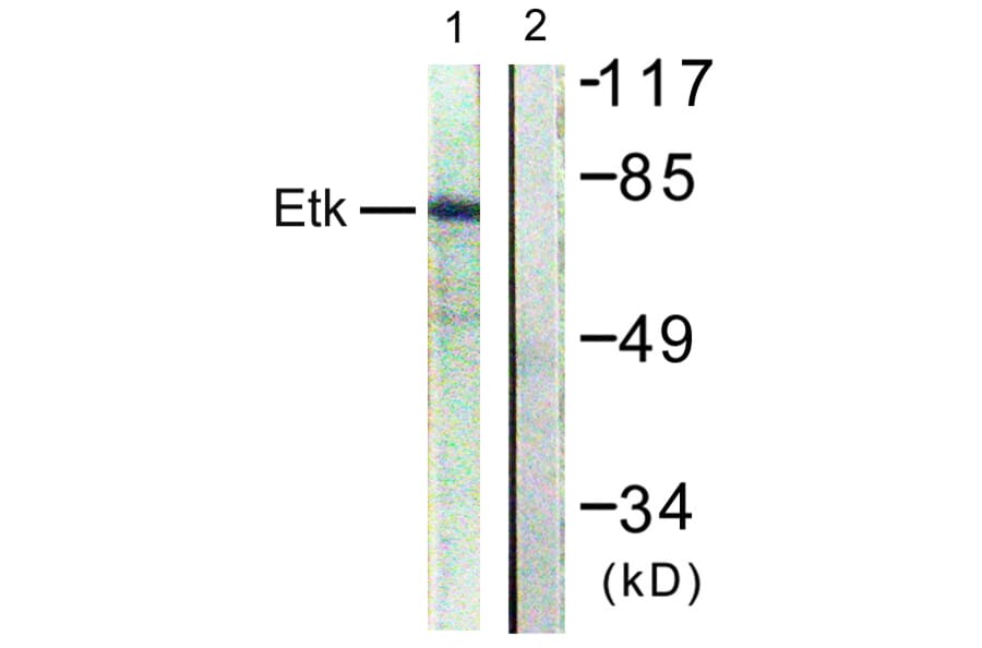 Western Blot - Anti-ETK Antibody (B0645) - Antibodies.com