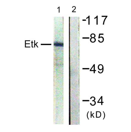 Western Blot - Anti-ETK Antibody (B0645) - Antibodies.com