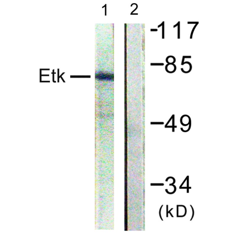Western Blot - Anti-ETK Antibody (B0645) - Antibodies.com