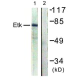 Western Blot - Anti-ETK Antibody (B0645) - Antibodies.com