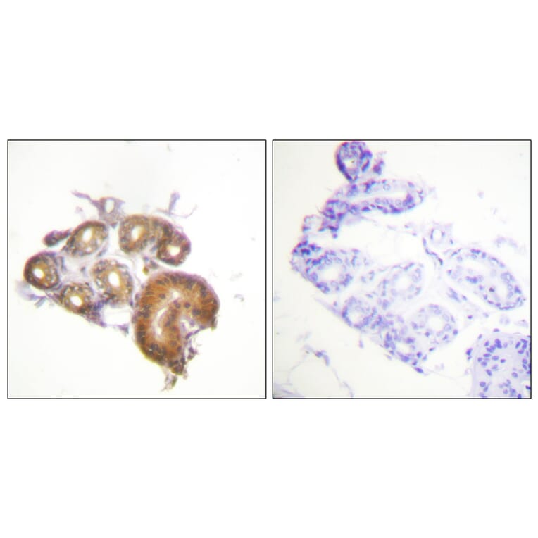 Immunohistochemistry - Anti-ETK Antibody (B0645) - Antibodies.com