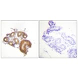 Immunohistochemistry - Anti-ETK Antibody (B0645) - Antibodies.com