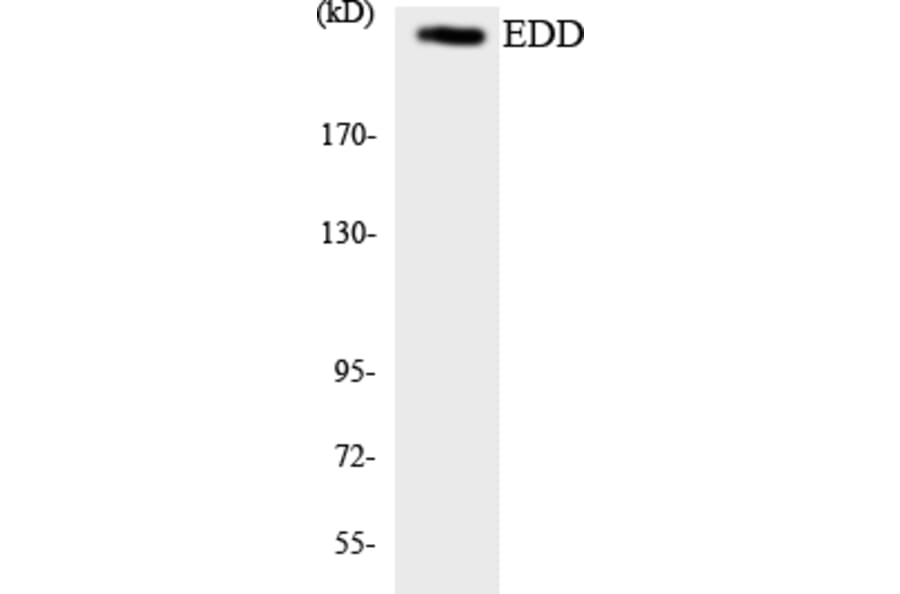 Western Blot - Anti-EDD Antibody (R12-2719) - Antibodies.com