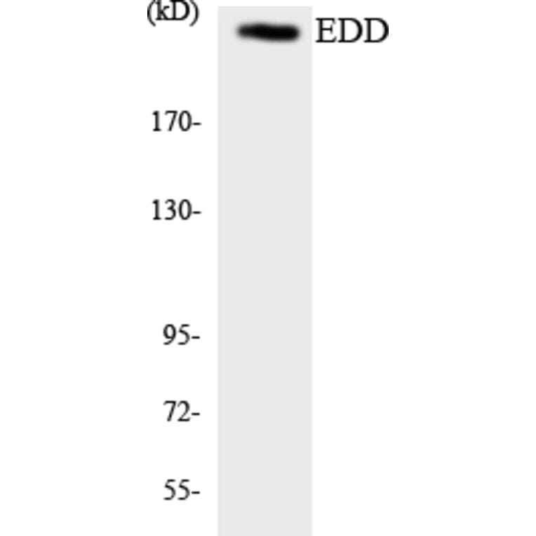 Western Blot - Anti-EDD Antibody (R12-2719) - Antibodies.com