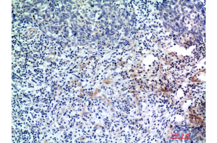 Immunohistochemistry - Anti-EDA Antibody (C30216) - Antibodies.com