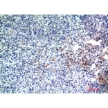 Immunohistochemistry - Anti-EDA Antibody (C30216) - Antibodies.com