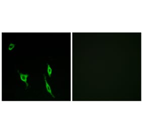 Immunofluorescence - Anti-DCC Antibody (C13040) - Antibodies.com