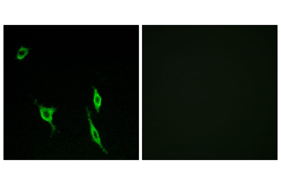 Immunofluorescence - Anti-DCC Antibody (C13040) - Antibodies.com