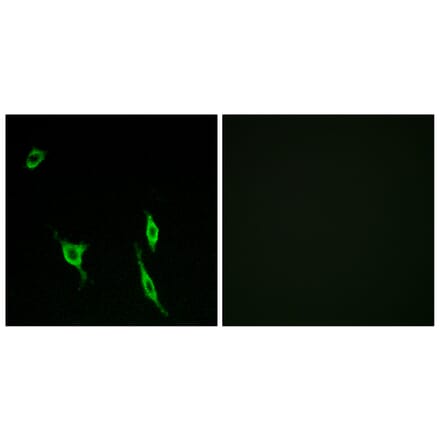 Immunofluorescence - Anti-DCC Antibody (C13040) - Antibodies.com