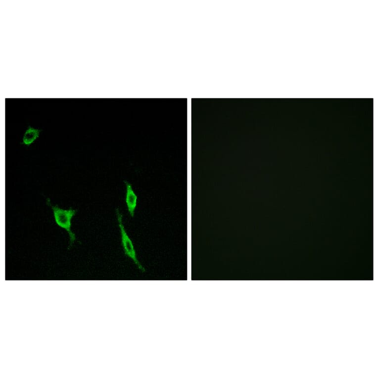 Immunofluorescence - Anti-DCC Antibody (C13040) - Antibodies.com
