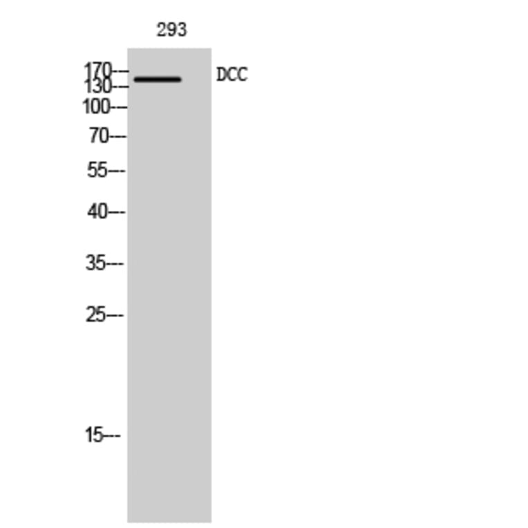 Western Blot - Anti-DCC Antibody (C13040) - Antibodies.com