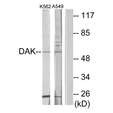 Western Blot - Anti-DAK Antibody (C11155) - Antibodies.com