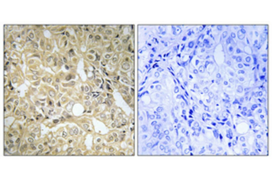 Immunohistochemistry - Anti-DAK Antibody (C11155) - Antibodies.com