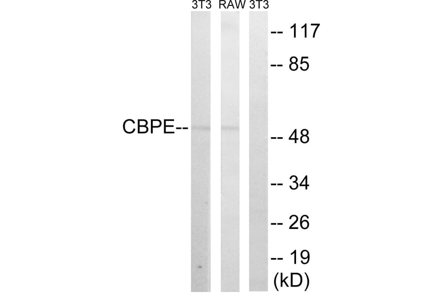 Western Blot - Anti-CPE Antibody (C14961) - Antibodies.com