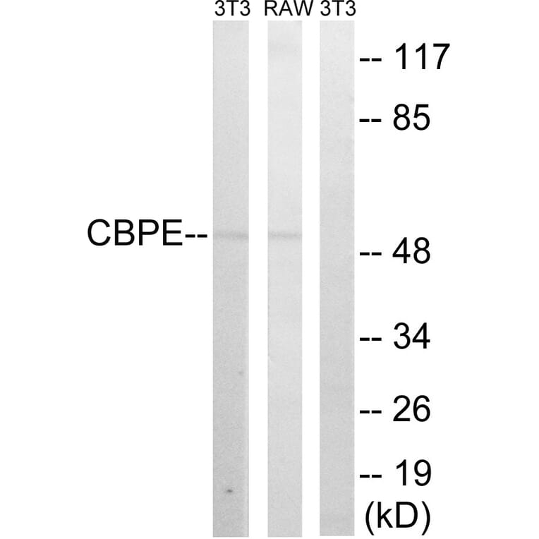 Western Blot - Anti-CPE Antibody (C14961) - Antibodies.com