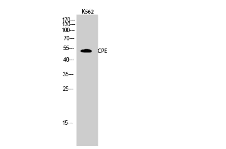 Western Blot - Anti-CPE Antibody (C14961) - Antibodies.com