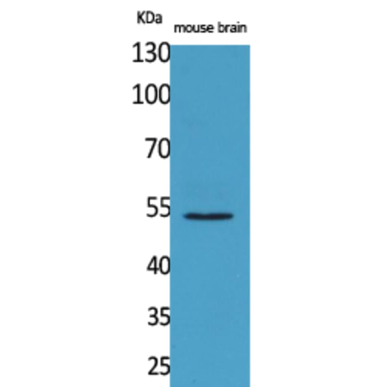 Western Blot - Anti-CPE Antibody (C30071) - Antibodies.com