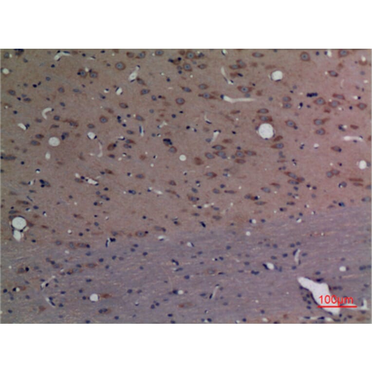 Immunohistochemistry - Anti-CPE Antibody (C30071) - Antibodies.com