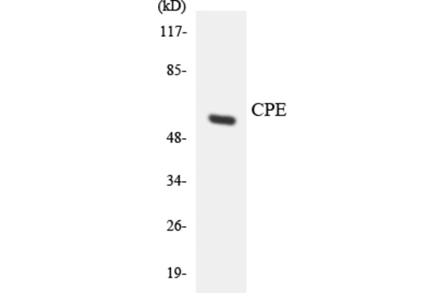 Western Blot - Anti-CPE Antibody (R12-2648) - Antibodies.com