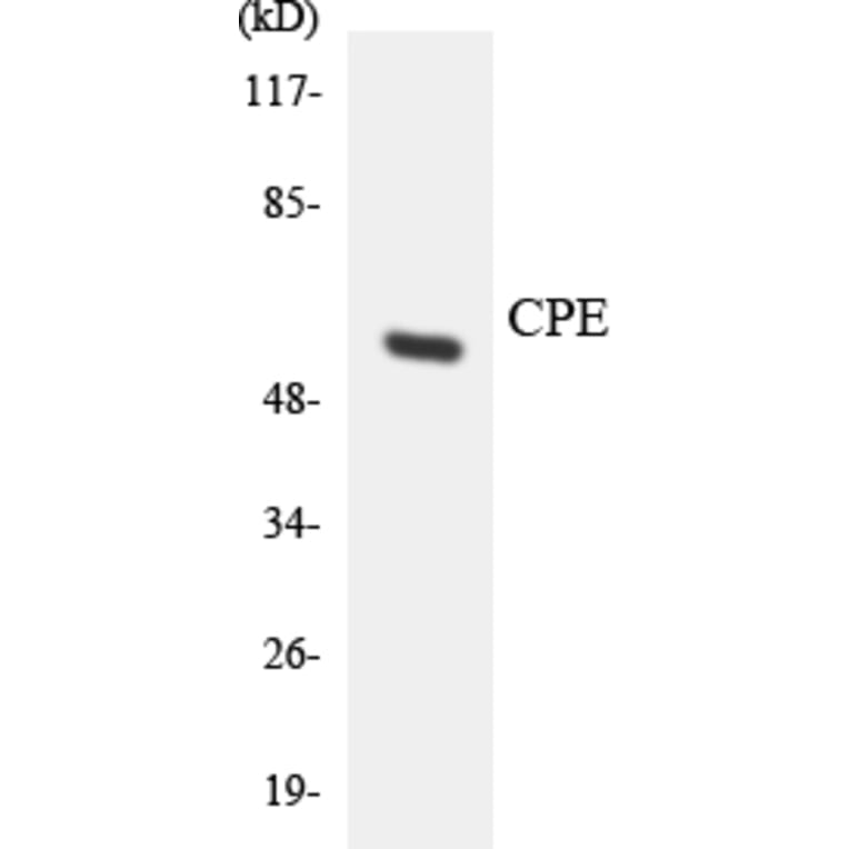 Western Blot - Anti-CPE Antibody (R12-2648) - Antibodies.com