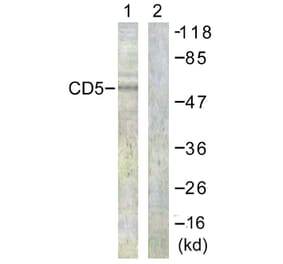 Western Blot - Anti-CD5 Antibody (B0849) - Antibodies.com