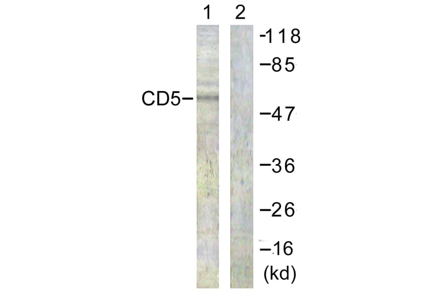 Western Blot - Anti-CD5 Antibody (B0849) - Antibodies.com