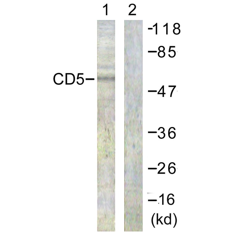 Western Blot - Anti-CD5 Antibody (B0849) - Antibodies.com