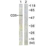 Western Blot - Anti-CD5 Antibody (B0849) - Antibodies.com