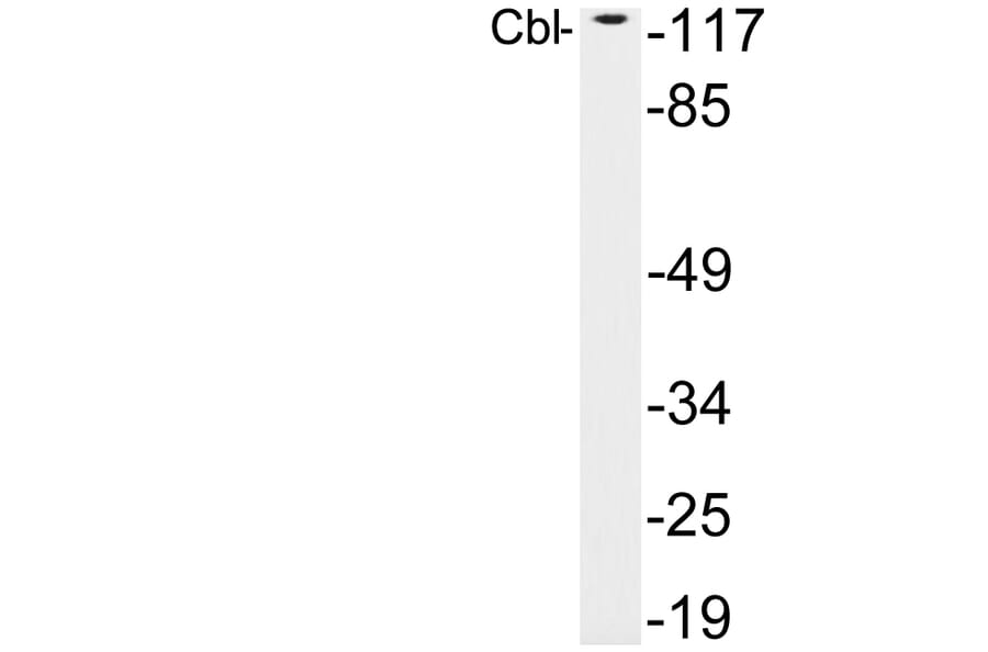 Western Blot - Anti-Cbl Antibody (R12-2062) - Antibodies.com