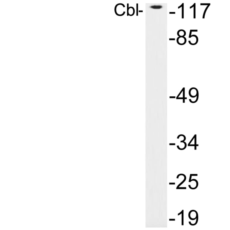 Western Blot - Anti-Cbl Antibody (R12-2062) - Antibodies.com