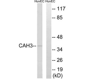 Western Blot - Anti-CA3 Antibody (C14939) - Antibodies.com