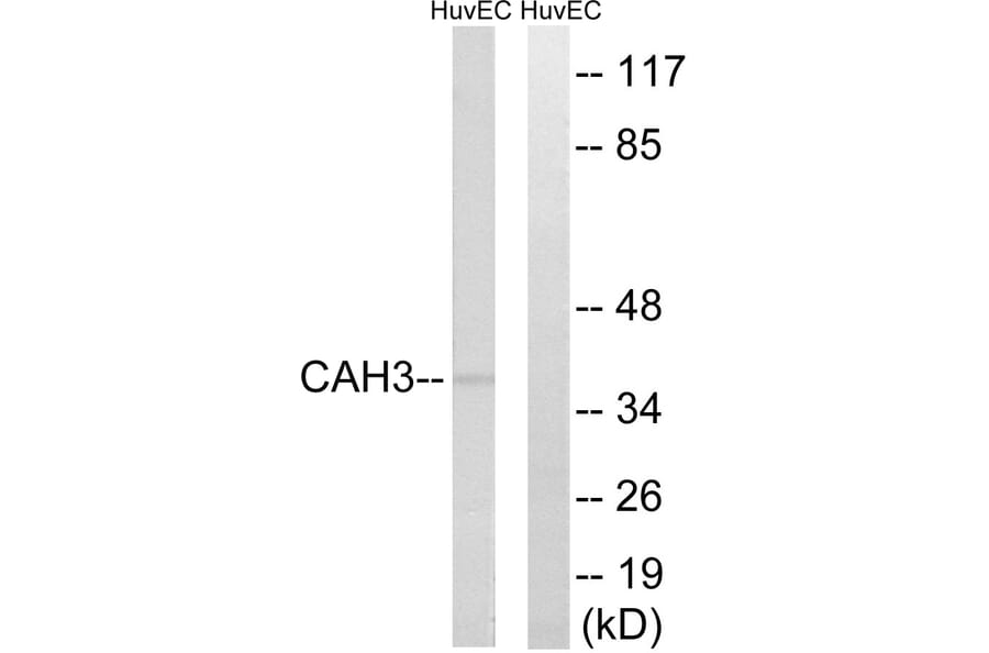 Western Blot - Anti-CA3 Antibody (C14939) - Antibodies.com