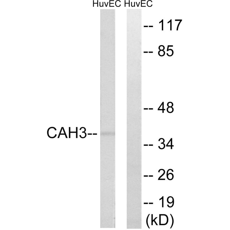Western Blot - Anti-CA3 Antibody (C14939) - Antibodies.com