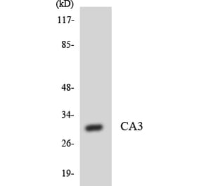 Western Blot - Anti-CA3 Antibody (R12-2556) - Antibodies.com