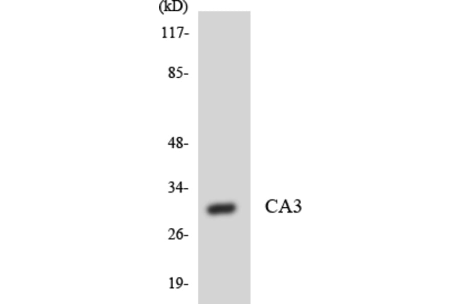 Western Blot - Anti-CA3 Antibody (R12-2556) - Antibodies.com