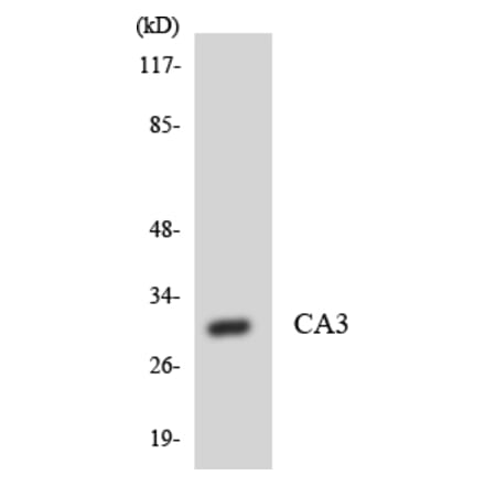 Western Blot - Anti-CA3 Antibody (R12-2556) - Antibodies.com