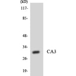 Western Blot - Anti-CA3 Antibody (R12-2556) - Antibodies.com
