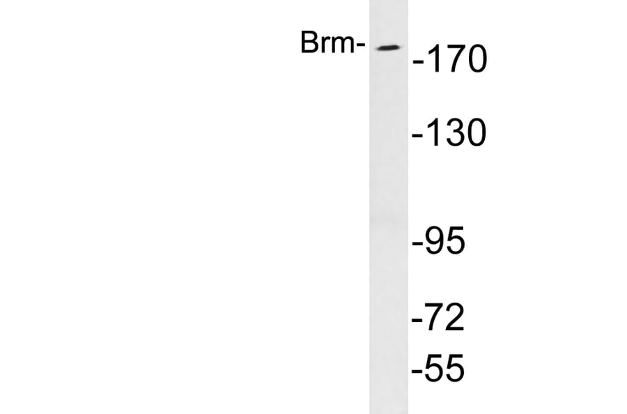 Western Blot - Anti-Brm Antibody (R12-2045) - Antibodies.com