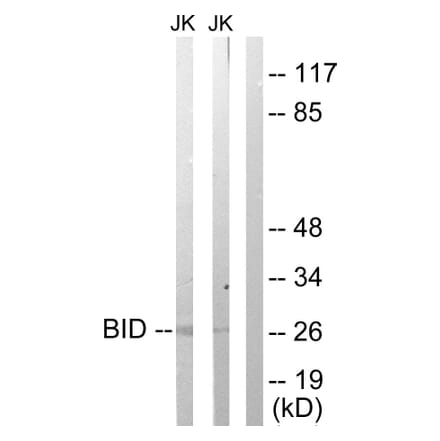 Western Blot - Anti-BID Antibody (B0461) - Antibodies.com