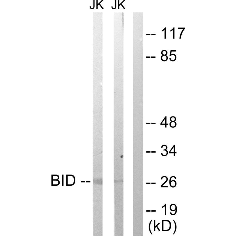 Western Blot - Anti-BID Antibody (B0461) - Antibodies.com