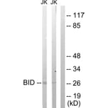 Western Blot - Anti-BID Antibody (B0461) - Antibodies.com