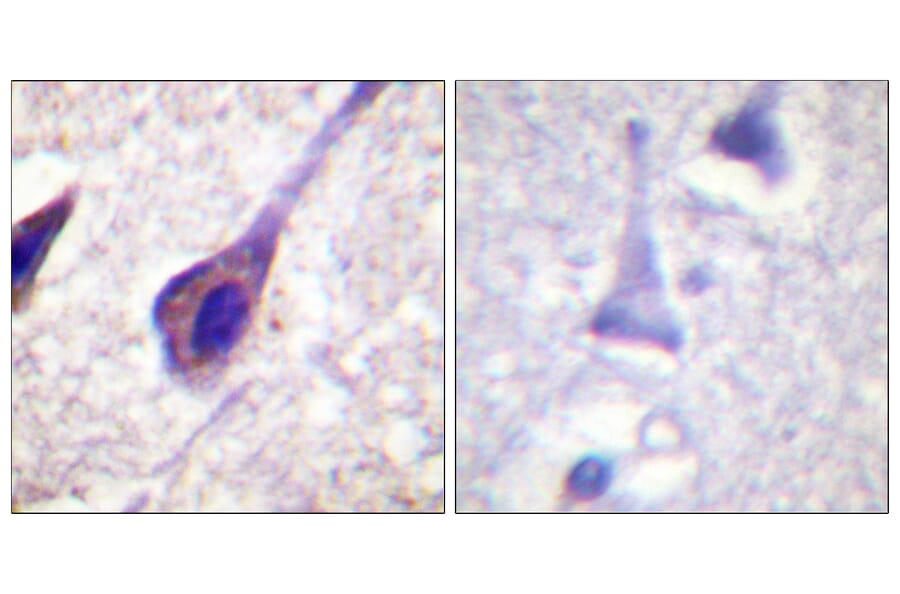 Immunohistochemistry - Anti-BID Antibody (B0461) - Antibodies.com