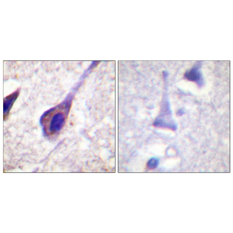 Immunohistochemistry - Anti-BID Antibody (B0461) - Antibodies.com