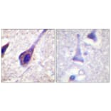 Immunohistochemistry - Anti-BID Antibody (B0461) - Antibodies.com