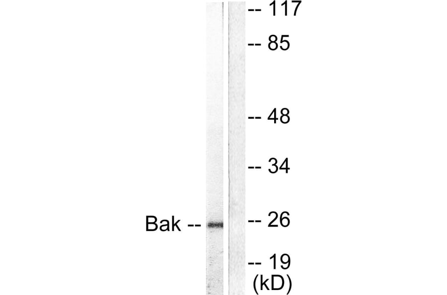Western Blot - Anti-Bak Antibody (C0131) - Antibodies.com