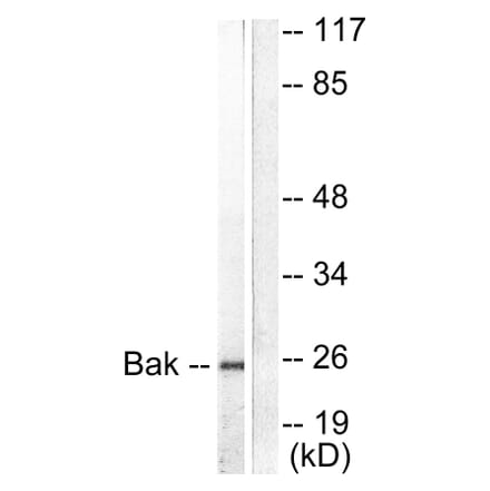 Western Blot - Anti-Bak Antibody (C0131) - Antibodies.com